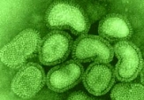Blíží se virus prasečí chřipky do Rakovníka?